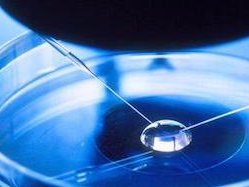 女性排卵困难如何进行试管手术