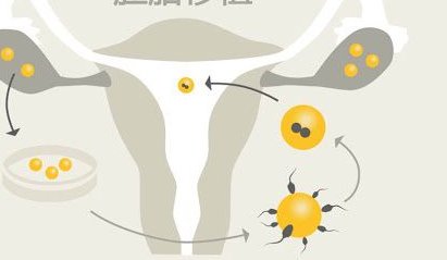 江门新会区在哪做试管婴儿，江门哪里可以做试管婴儿