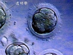 2026年想去永济市做试管婴儿需要准备哪些事？详细收费明细一览